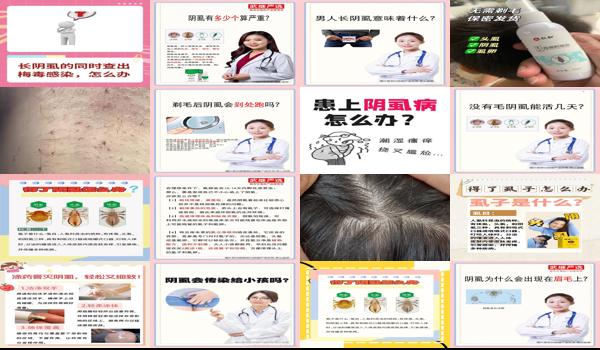 头上发现阴虱 - 汕头有了阴虱怎么办