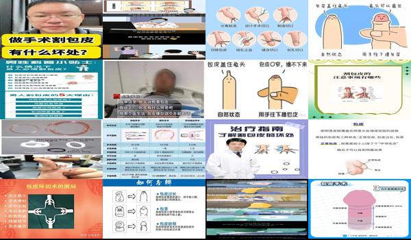 汕头割包皮价格 - 汕头割包皮有什么作用