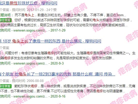 汕头男性 - 汕头男人龟头上长疱疹图片