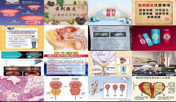 汕头前列腺哪个医院好 - 汕头前列腺的特征有哪些