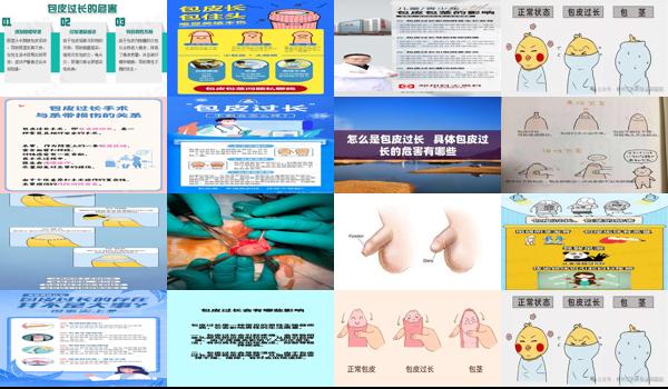 包皮过长会影响生育 - 汕头包皮过长会影响