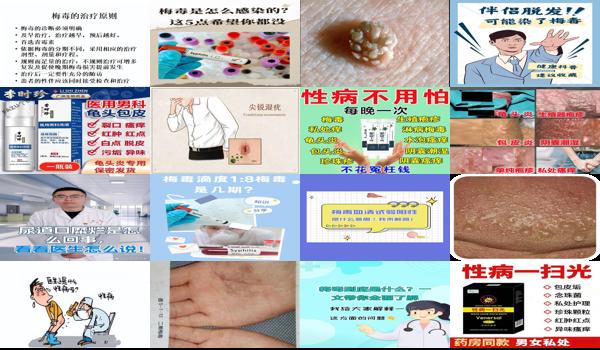 汕头龟的图片 - 汕头龟头痒是不是种梅毒了