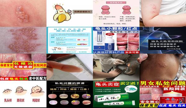 汕头包皮手术多少钱 - 汕头包皮疱疹怎么办