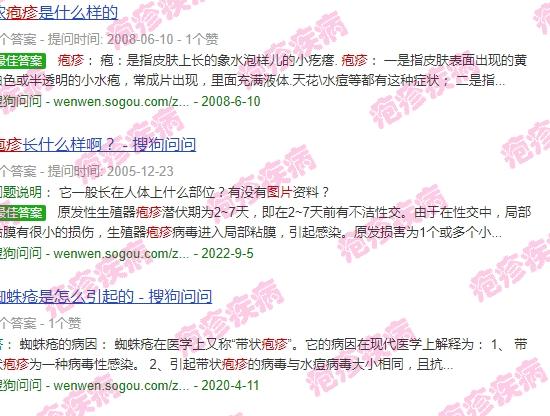 汕头有带状疱疹疫苗吗 - 汕头疱疹有几种类型和图片