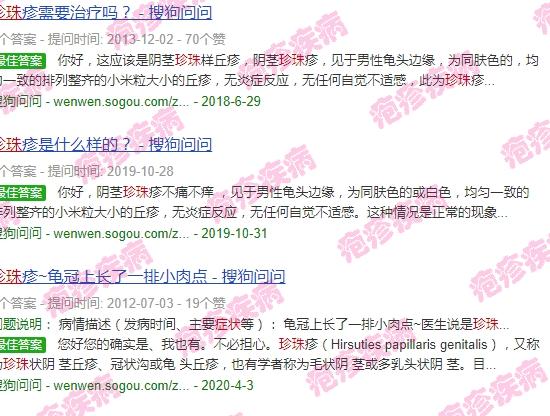 汕头有珍珠市场吗 - 汕头珍珠疱疹症状图片