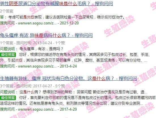 阴径腥臭是什么原因 - 汕头阴茎腥臭味是什么炎症