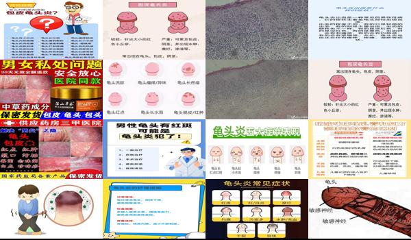汕头有男性男科医院吗 - 汕头男性龟头炎症状常见有哪些