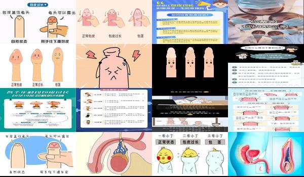 包皮过长影响生孩子吗? - 汕头包皮过长影响做爱吗