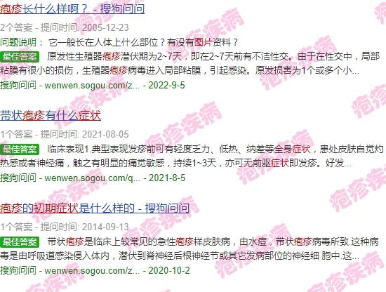 汕头冠状**新消息 - 汕头疱疹图片初期症状图片