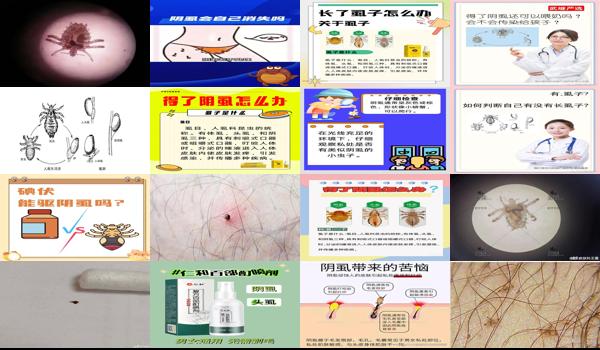 怎么检查是不是阴虱 - 汕头怎么判断自己是不是得了阴虱