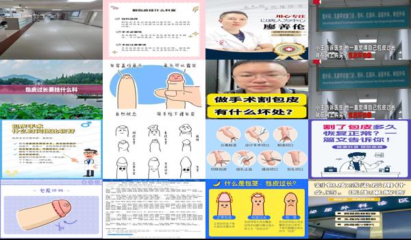 汕头割包皮挂什么科室的号 - 汕头割包皮挂什么科