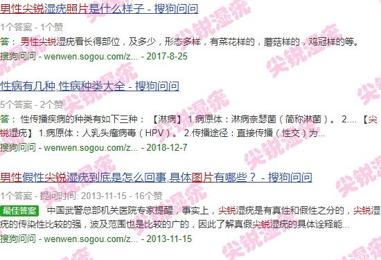 汕头治疗尖锐*好的医院 - 汕头男性尖锐初期图片百度