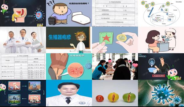 生值器疱疹传染吗 - 汕头生值器疱疹感染*