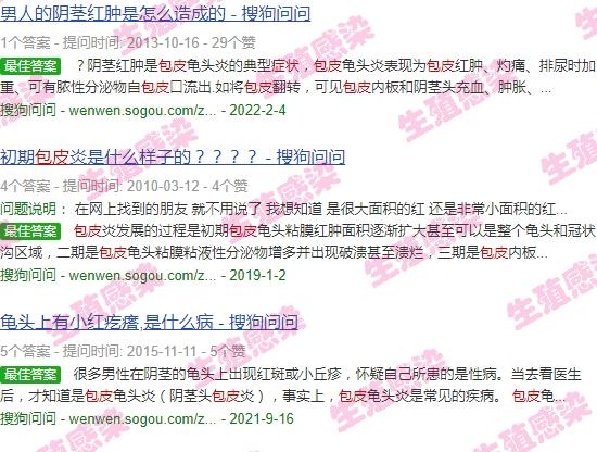 包皮过长感染怎么治疗 - 汕头包皮过长感染发炎症状