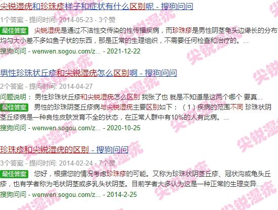 珍珠疹与尖锐湿疹区别有那些 - 汕头珍珠疹和尖锐湿疣的区别