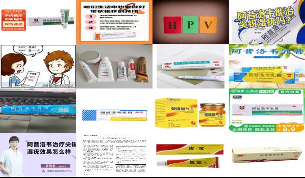 阿昔洛韦乳膏治疗尖锐 - 汕头阿昔洛韦软膏治疗尖锐湿疣