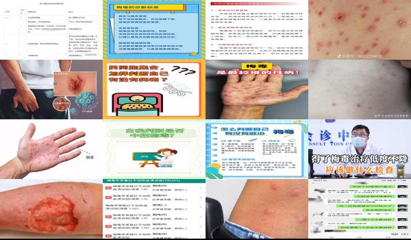 怎么检测是不是得了梅毒 - 汕头怎样判断自己得没得梅毒