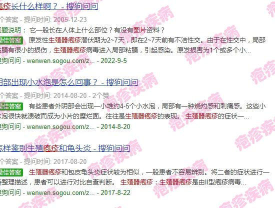 生殖嚣疱疹图片 - 汕头2018生殖器疱疹图片