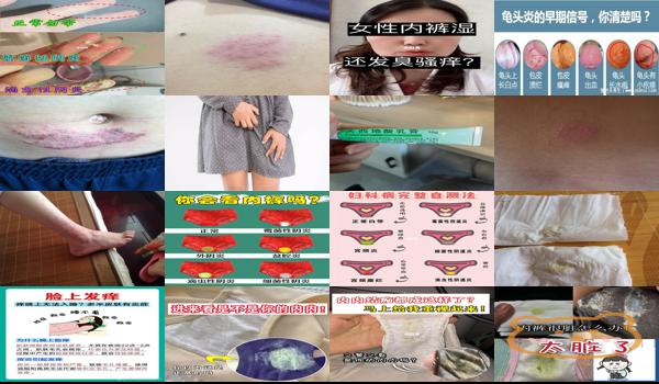 为什么没有炎症,下面还是很痒 - 汕头为什么没有炎症下面还是痒
