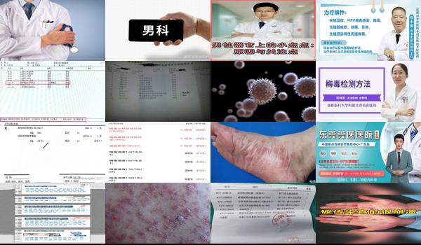 汕头男性去医院检查有没有梅毒挂什么科室 - 汕头男性去医院检查有没有梅毒挂什么科