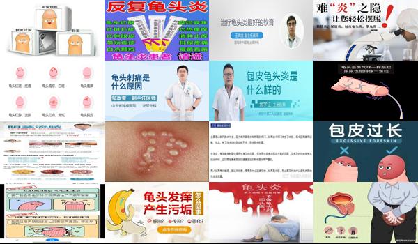 汕头男科性疾病 - 汕头龟头炎症的话正常情况下，自然好得多久