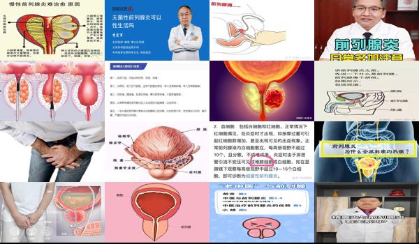 前列腺炎不管他会怎么样 - 汕头前列腺炎不管会怎样