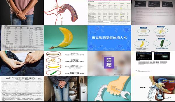 汕头男性 - 汕头勃起障碍是怎么回事
