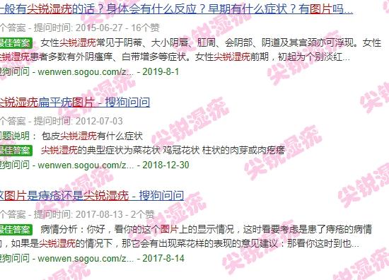 尖头湿锐疣图片 - 汕头尖锐湿犹图片大*