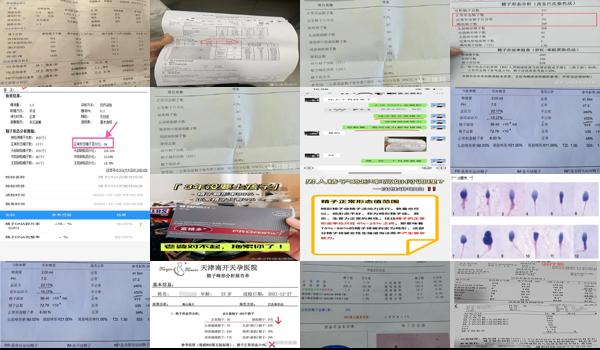 汕头男性结扎医院 - 汕头精子畸形*高是有炎症吗