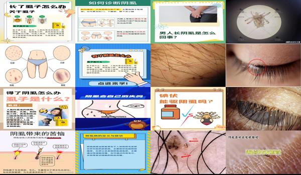 怎么检查是不是得了阴虱 - 汕头怎么判断自己得了阴虱
