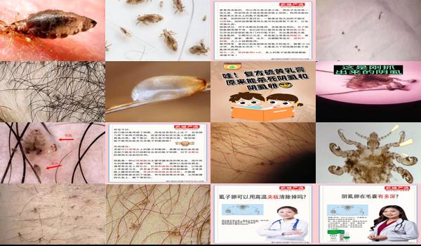 怎样把阴虱卵弄干净 - 汕头怎么把阴虱卵弄出来