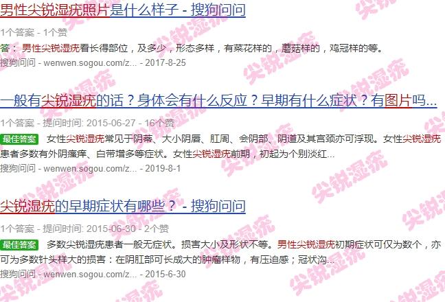 男性尖锐湿尤图治疗费用 - 汕头男人尖锐湿疣照片