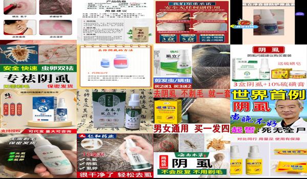 阴虱头虱 - 汕头阴虱用什么去除