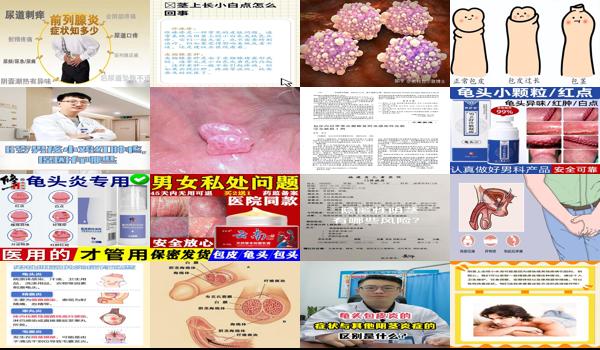 汕头男科性疾病 - 汕头阴茎炎症感染症状