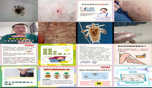 头虱阴虱 - 汕头阴虱是怎么来的