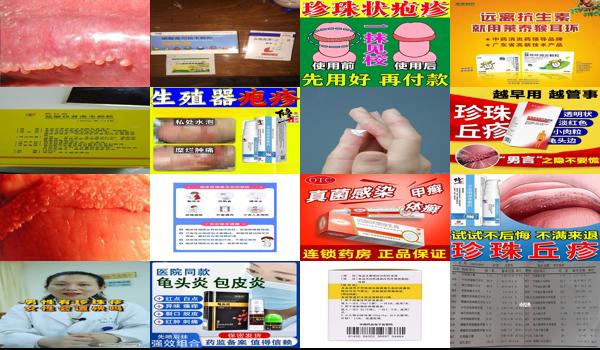 珍珠孢疹怎么治 - 汕头珍珠疹疱疹颗粒怎么处理