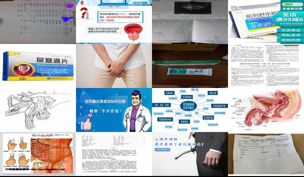 前列腺炎症状严重分级 - 汕头前列腺炎严重程度分级