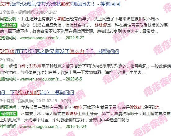 珍珠孢疹怎么治 - 汕头珍珠疹疱疹颗粒怎么处理