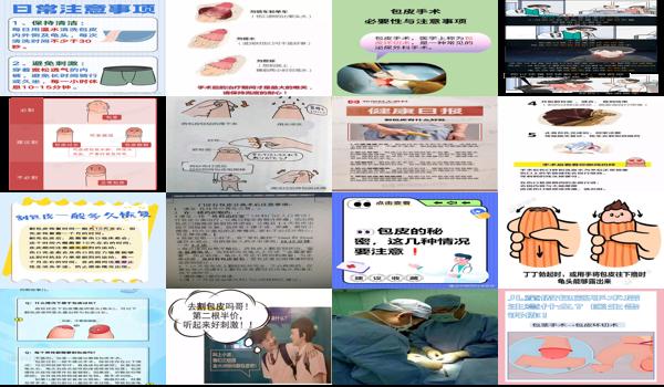 汕头割包皮需要多少钱 - 汕头割包皮要注意什么