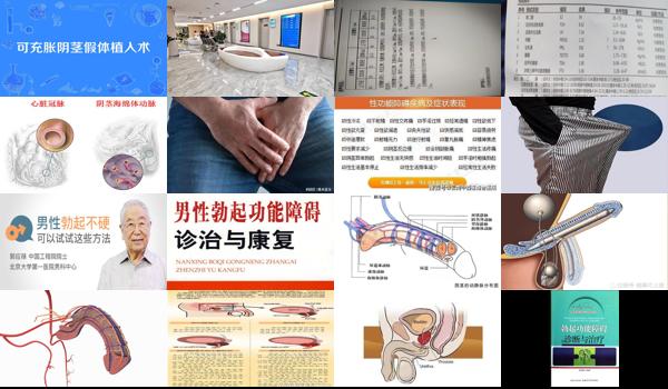 汕头有没有*男科医院 - 汕头性功能勃起障碍能治愈吗