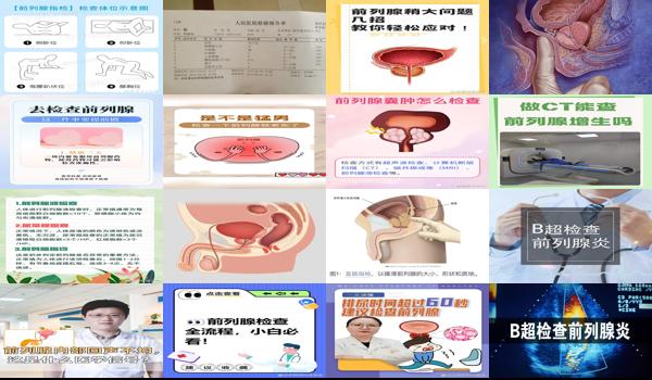 前列腺医院如何检查 - 汕头前列腺 怎么检查