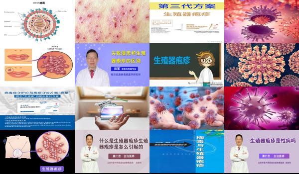 生殖疱疹用什么清洗剂 - 汕头生殖器疱疹要用什么清洗