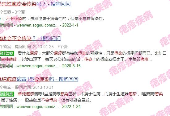 单纯疱疹性传播吗 - 汕头单纯性疱疹会不会传染