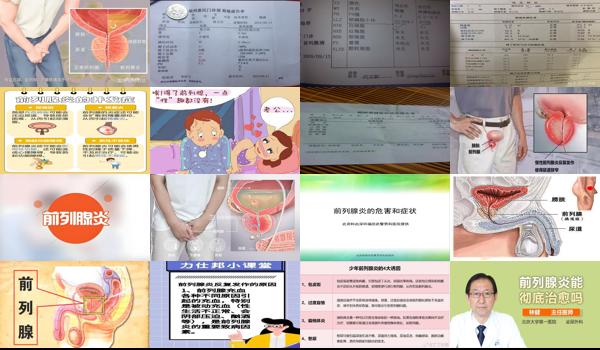 前列腺炎 影响怀孕 - 汕头前列腺炎影响怀孕嘛