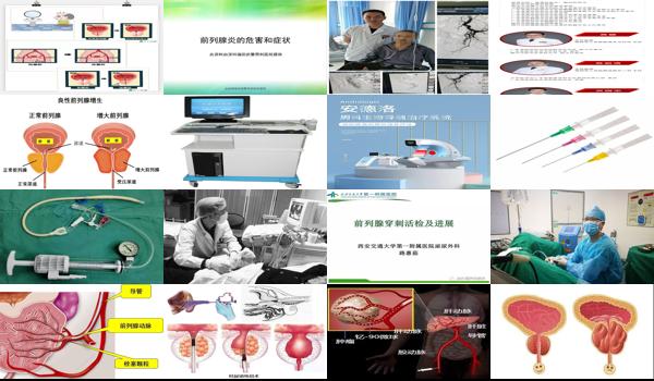 汕头前列腺介入疗法费用多少钱 - 汕头前列腺介入疗法费用