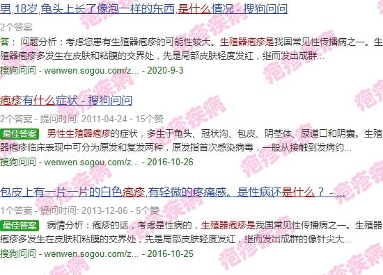 男士生殖疱疹 - 汕头男性生殖器疱疹是什么