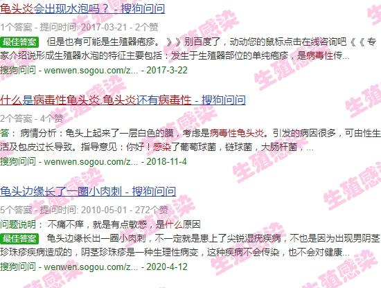 汕头有*感染者吗 - 汕头*性感染龟头炎症状有哪些
