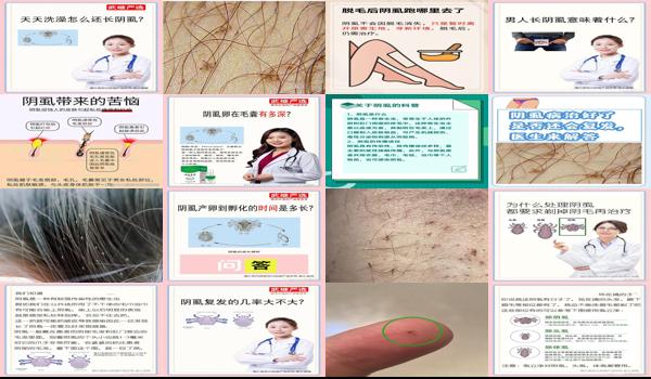 汕头为什么下这么大的暴雨 - 汕头下面为什么会长阴虱