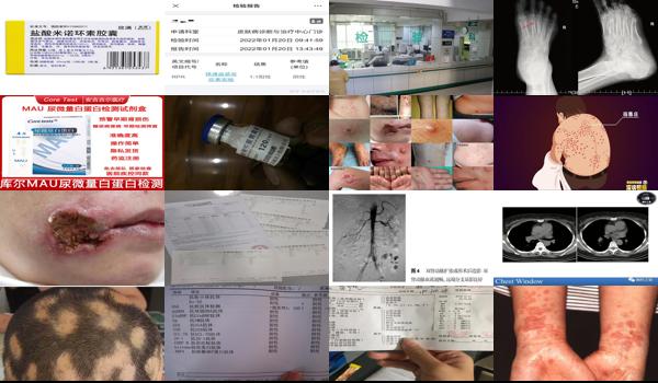 汕头梅毒肾病医院* - 汕头梅毒肾病