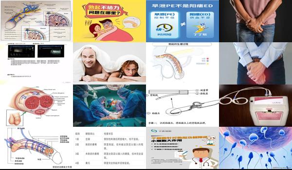 汕头有男性男科医院吗 - 汕头男人勃起功能障碍检查什么